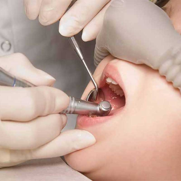 kids dentist treatment kids dentist treatment