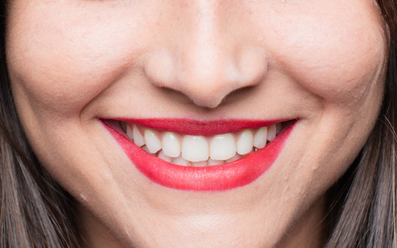 Top 10 Daily Habits to Maintain Healthy Teeth and Gums